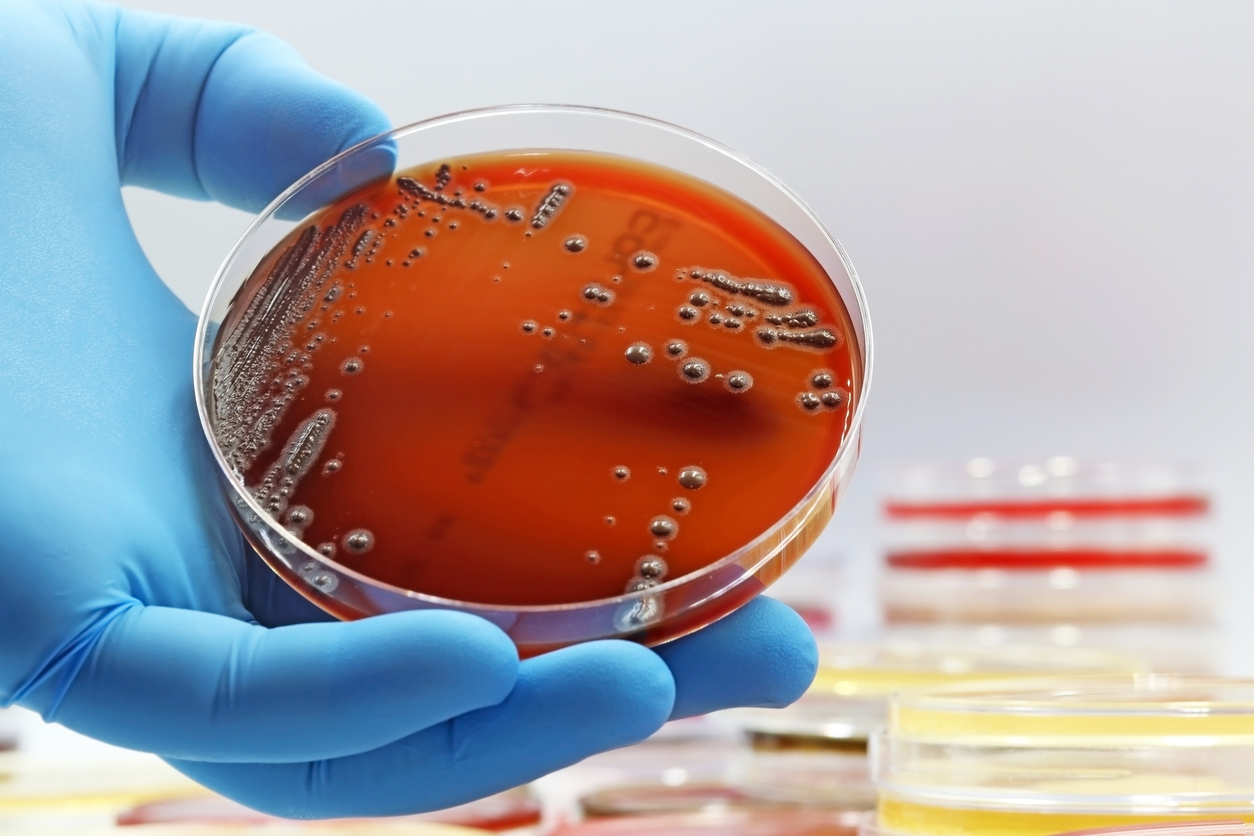 Workforce Development - rTCR & Sampling Plan, Techniques, Basic Microbiology, Certification and Resource Monitoring
